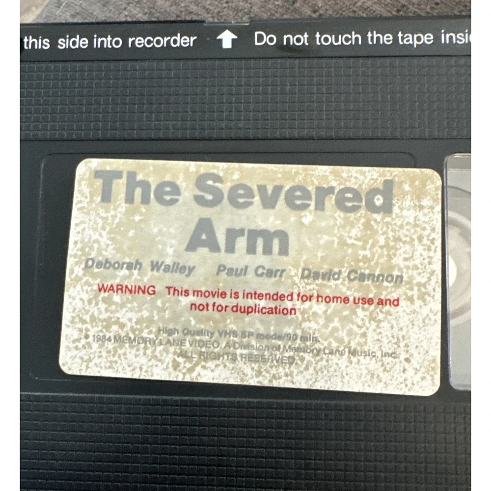 N/A severed arm